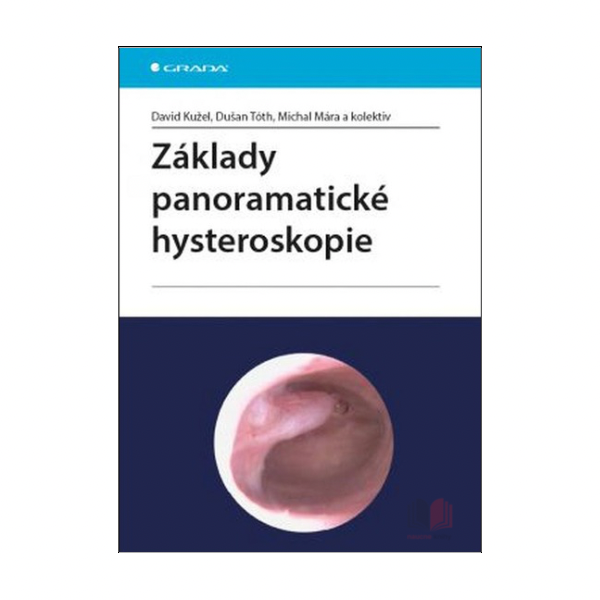 Základy panoramatické hysteroskopie