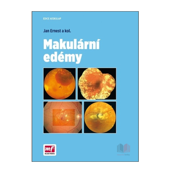 Makulární edémy