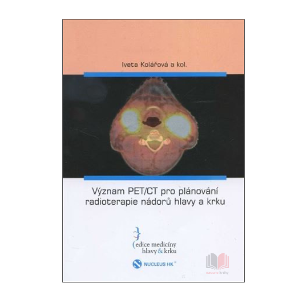 Význam PET/CT pro plánování radioterapie nádorů hlavy a krku