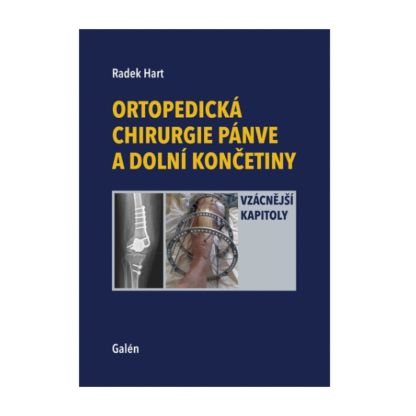Ortopedická chirurgie pánve a dolní končetiny